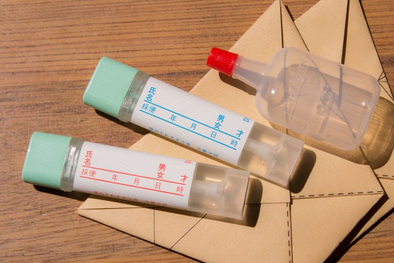 驚くほど変わる笑顔の秘密審美矯正で理想の歯並びを手に入れる